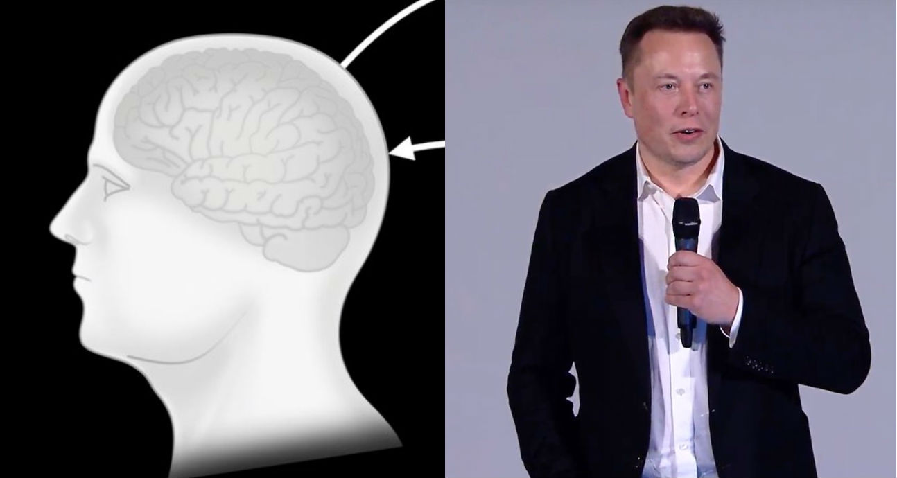 Elon Musk to unveil Neuralink progress with real-time neuron demonstration this week