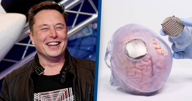 Elon Musk Says Human Trial Of Neuralink Brain Chip Could Begin This Year